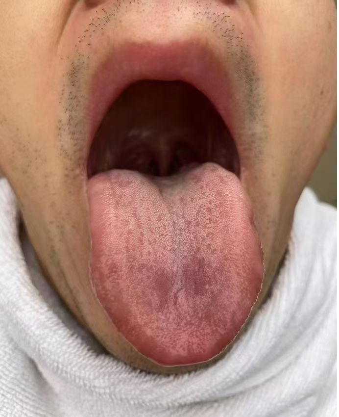 舌象样片